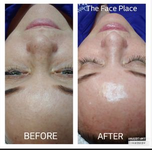 The Face Place photo 19