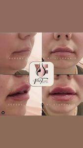 VitalMed Spa photo 11