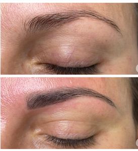 Diamond Face Esthetics photo 15