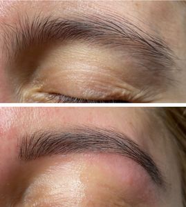 Diamond Face Esthetics photo 16