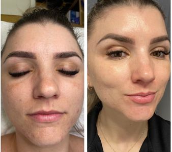 Diamond Face Esthetics photo 18