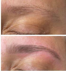 Diamond Face Esthetics photo 19