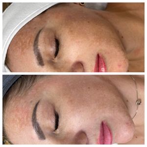 Diamond Face Esthetics photo 23