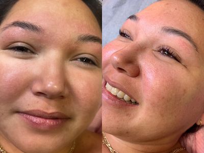 Skin renewal aesthetics photo 2