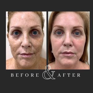 Yag-Howard Cosmetic Dermatology photo 45