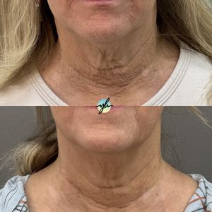 Yag-Howard Cosmetic Dermatology photo 47