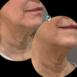 Yag-Howard Cosmetic Dermatology photo 50