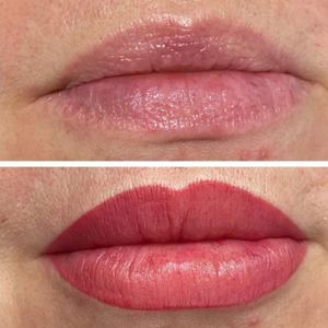 Naples Aesthetic Institute: Kiran Gill, MD photo 16