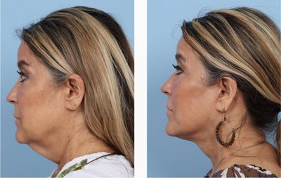 Naples Aesthetic Institute: Kiran Gill, MD photo 48