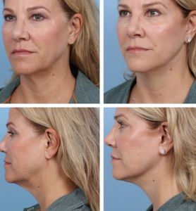 Naples Aesthetic Institute: Kiran Gill, MD photo 51