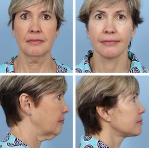 Naples Aesthetic Institute: Kiran Gill, MD photo 53