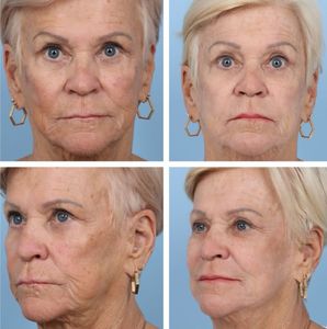 Naples Aesthetic Institute: Kiran Gill, MD photo 57