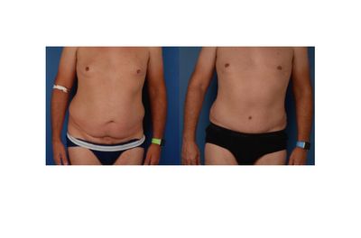 Naples Aesthetic Institute: Kiran Gill, MD photo 61