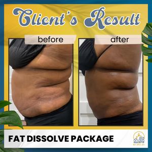 Your Choice Spa photo 46