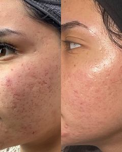 My Beauty Restored photo 8