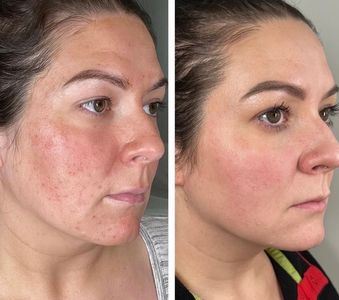 My Beauty Restored photo 9