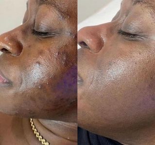 My Beauty Restored photo 14