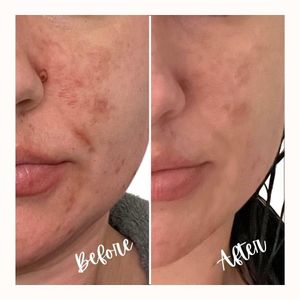 My Beauty Restored photo 16