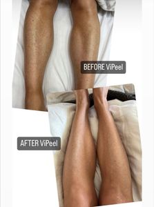 My Beauty Restored photo 18