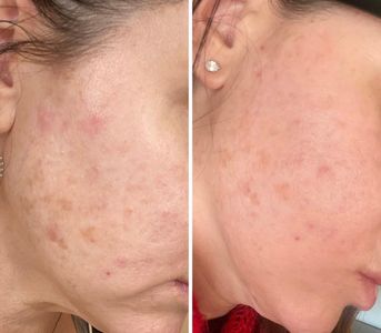 My Beauty Restored photo 19