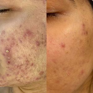 My Beauty Restored photo 20