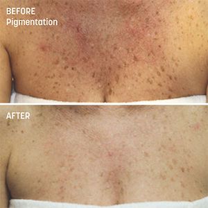 My Beauty Restored photo 22