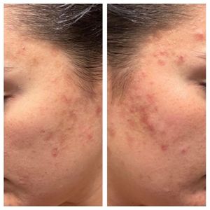 My Beauty Restored photo 23