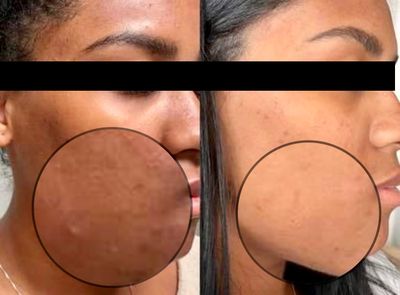 My Beauty Restored photo 24