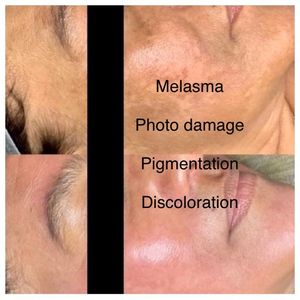 My Beauty Restored photo 25