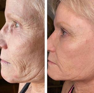 My Beauty Restored photo 34