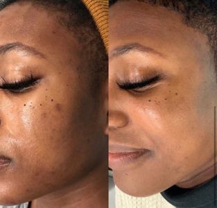 My Beauty Restored photo 38