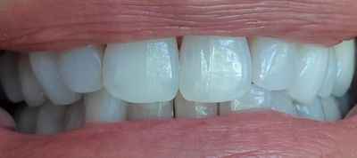 Pure Dental photo 19