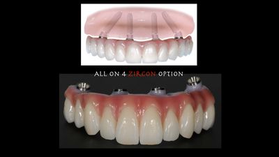 Specialists in Implant Dentistry – Dr Matthew Holtan photo 37