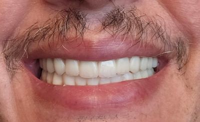 Naples Dental and Wellness Center photo 3