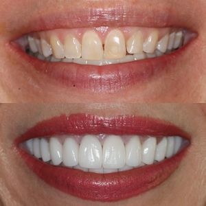 Chandra Smile Designs