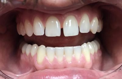 World Dental Associates photo 8