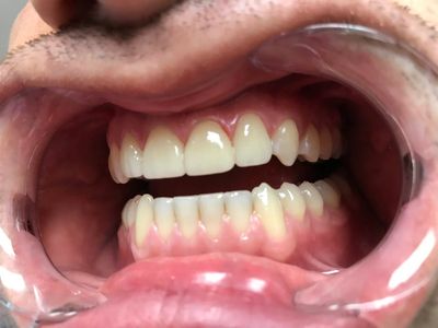 World Dental Associates photo 28