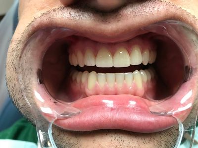 World Dental Associates photo 29