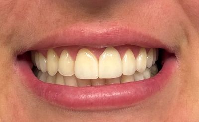 Prosthodontics and Implant Therapy Tampa photo 4