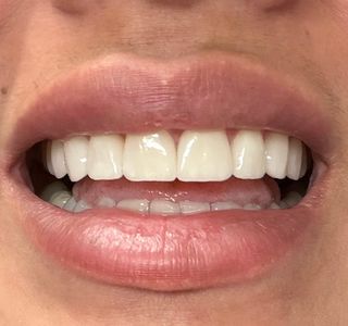 Prosthodontics and Implant Therapy Tampa photo 24