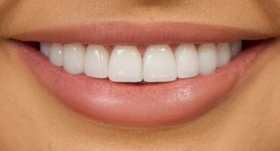 Muscaro & Martini Dentistry photo 7