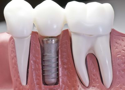 Muscaro & Martini Dentistry photo 14