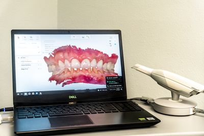 Sunset Point Dental – Clearwater photo 10