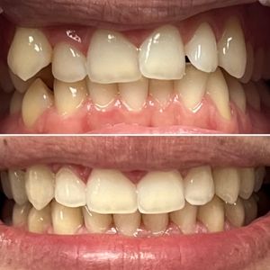 Sunset Point Dental – Clearwater photo 17