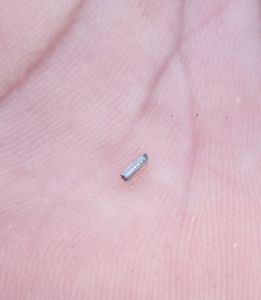 Florida Dental Centers of Clearwater photo 20