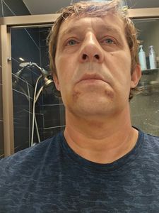 Florida Dental Centers of Clearwater photo 27