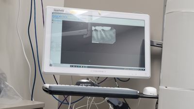 Florida Dental Centers of Clearwater photo 34