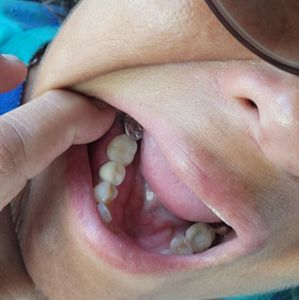 Florida Dental Centers of Clearwater photo 36