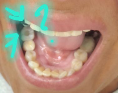 Florida Dental Centers of Clearwater photo 37