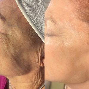 Lynn Roscioli Aesthetics photo 12